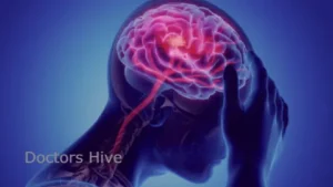 Neurology Doctors List